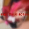 Thumbnail of related posts 118